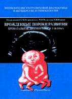 Скачать бесплатно книгу «Врожденные пороки развития: пренатальная диагностика и тактика», Петриковский Б.М.