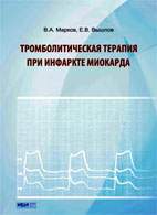 Скачать бесплатно книгу «Тромболитическая терапия при инфаркте миокарда», Марков В.А.