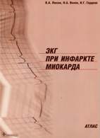 На фото ЭКГ при инфаркте миокарда - Люсов В.А. - Атлас
