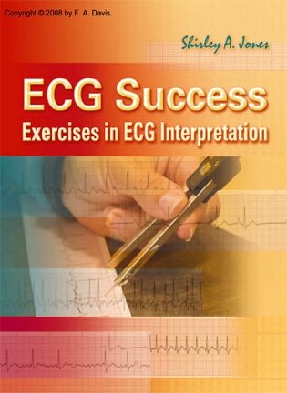 На фото ECG Success: Exercises in ECG Interpretation - Shirley A. Jones