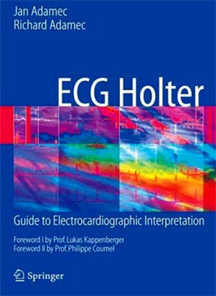 На фото ECG Holter: Guide to Electrocardiographic Interpretation - Adamec Jan