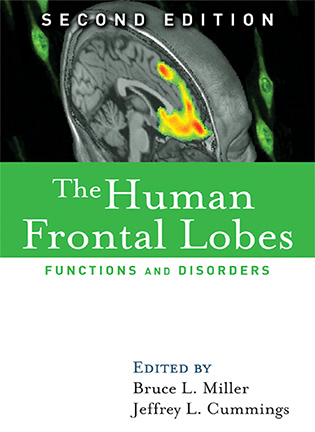 На фото The Human Frontal Lobes: Functions and Disorders - Bruce L. Miller
