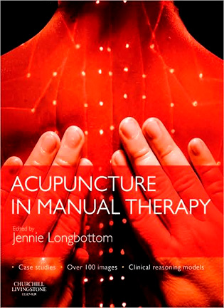 На фото Acupuncture in Manual Therapy - Jennie Longbottom