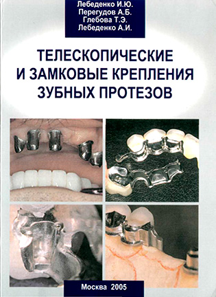На фото Телескопические и замковые крепления зубных протезов - Лебеденко И.Ю.
