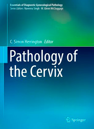 На фото Pathology of the Cervix - C. Simon Herrington