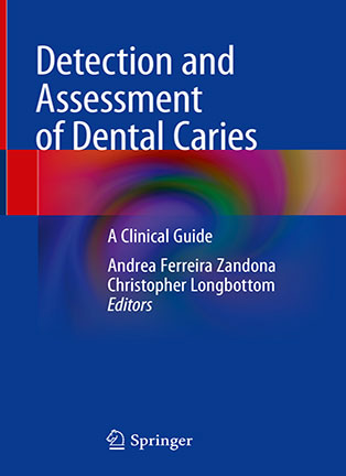 На фото Detection and Assessment of Dental Caries - Andrea Ferreira Zandona, Christopher Longbottom