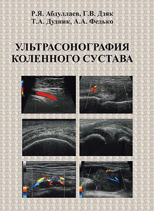 На фото Ультрасонография коленного сустава - Абдуллаев Р.Я.