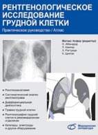 Скачать бесплатно книгу "Рентгенологическое исследование грудной клетки", Матиас Хофер.