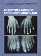 Скачать бесплатно книгу «Диффузные болезни соединительной ткани», Сигидин Я.А.