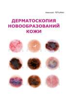 Скачать бесплатно книгу: Дерматоскопия новообразований кожи, Гетьман А.Д.