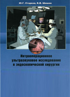 На фото Интраоперационное ультразвуковое исследование в эндоскопической хирургии - Старков Ю.Г.