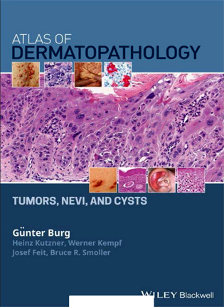 На фото Atlas of Dermatopathology - Gunter Burg