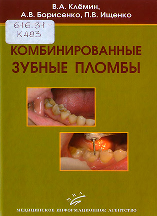 На фото Комбинированные зубные пломбы - Клёмин В.А.
