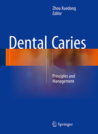 На фото Dental Caries: Principles and Management - Zhou Xuedong