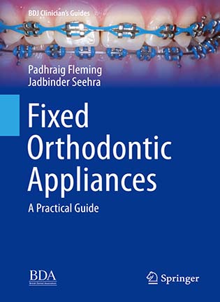 На фото Fixed Orthodontic Appliances - Padhraig  Fleming, Jadbinder Seehra
