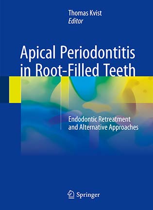 На фото Apical Periodontitis in Root-Filled Teeth - Thomas Kvist