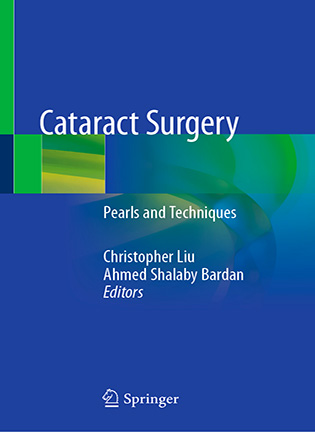 На фото Cataract Surgery - Christopher Liu, Ahmed Shalaby Bardan