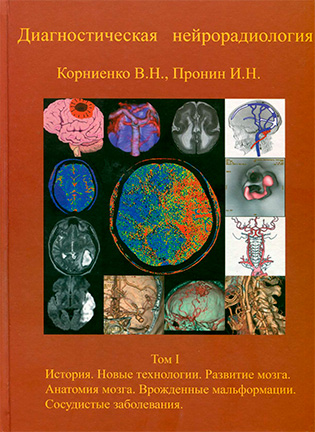 На фото Диагностическая нейрорадиология - Корниенко В.Н., Пронин И.Н. - Том 1