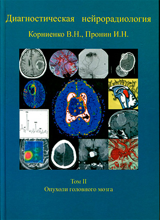 На фото Диагностическая нейрорадиология - Корниенко В.Н., Пронин И.Н. - Том 2