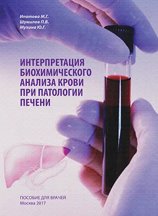 На фото Интерпретация биохимического анализа крови при патологии печени - Ипатова М. Г.