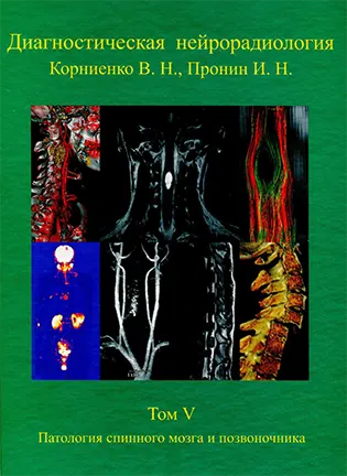 На фото Диагностическая нейрорадиология - Корниенко В.Н., Пронин И.Н. - Том 5