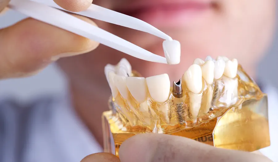 На фото Особенности ортопедической стоматологии