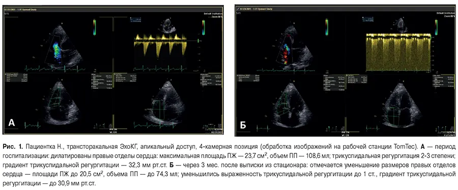 на фото Сердечно-сосудистый статус и динамика эхокардиографических показателей лиц, перенесших COVID-19 пневмонию, через три месяца после выписки из стационара