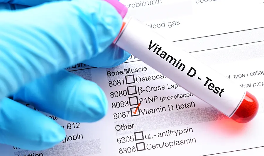 на фото Профилактика и лечение дефицита витамина D: выбор оптимального подхода