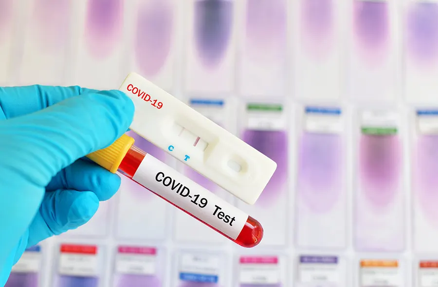 на фото Тест на коронавирус COVID-19